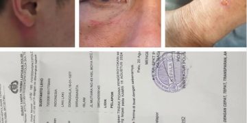 Tim Paslon BERANI Diduga Aniaya Crew Videotron Saat Deklarasi di Sigi